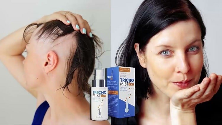 Odkryj Efektywność Produktu Trichomist Forte - Lek do Lepszej Skóry in Poland